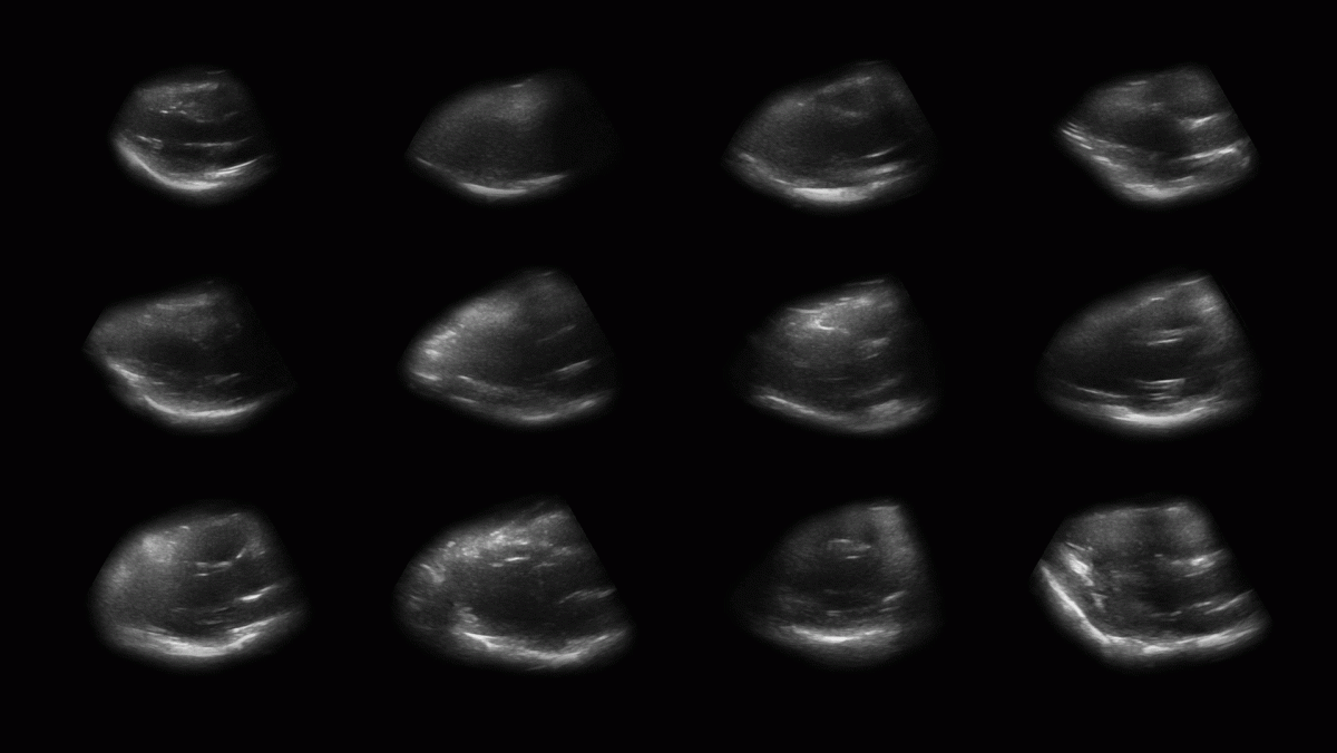 Sonogram portraits of heartbeats